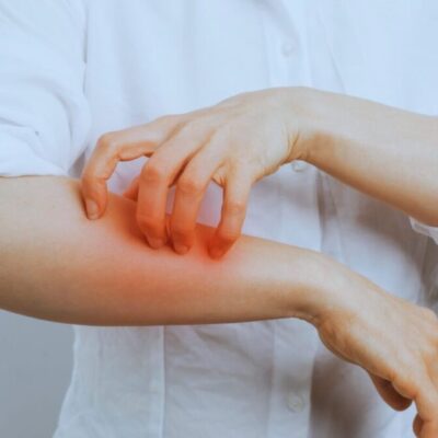 薬剤師 運営 健康情報サイト 紫外線