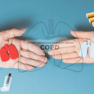 薬剤師 運営 健康情報サイト COPD